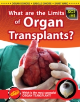 What Are the Limits of Organ Transplantation?