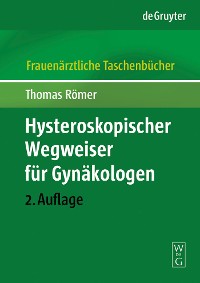 Hysteroskopischer Wegweiser für Gynäkologen