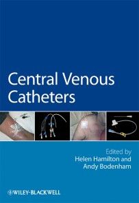 Central Venous Catheters Foto №1