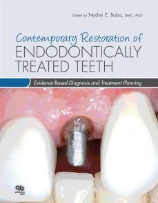 Contemporary Restoration of Endodontically Treated Teeth photo №1