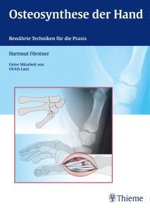 Osteosynthese der Hand - Medizin - Naturwissenschaften & Technik -  Fachbücher - eBooks