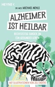 Alzheimer ist heilbar Foto №1