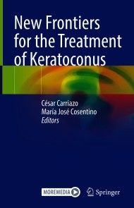New Frontiers for the Treatment of Keratoconus photo №1